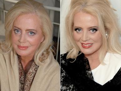 Creme antiageing