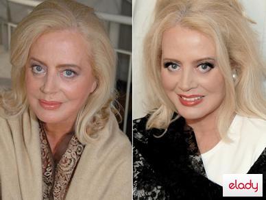 Creme antiageing